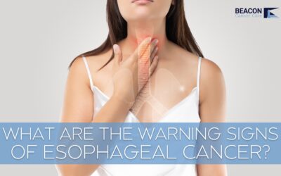 What Are the Early Warning Signs of Oesophageal Cancer?